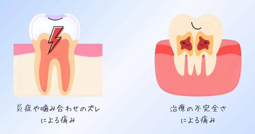 根管治療後に痛みが長引く2つの主な原因を示すイラスト。左は炎症や噛み合わせのズレ、右は治療の不完全さ。