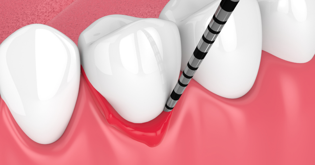 歯医者に相談したほうがよい状態と3つのサイン