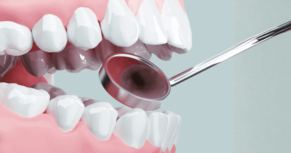 黒い虫歯を自分で判断しようとしている歯の状態を示すイメージ