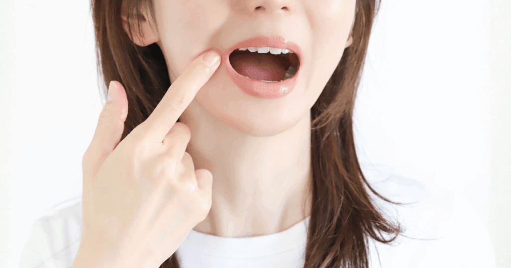 歯の違和感やトラブルを気にして口元を触る女性のイメージ