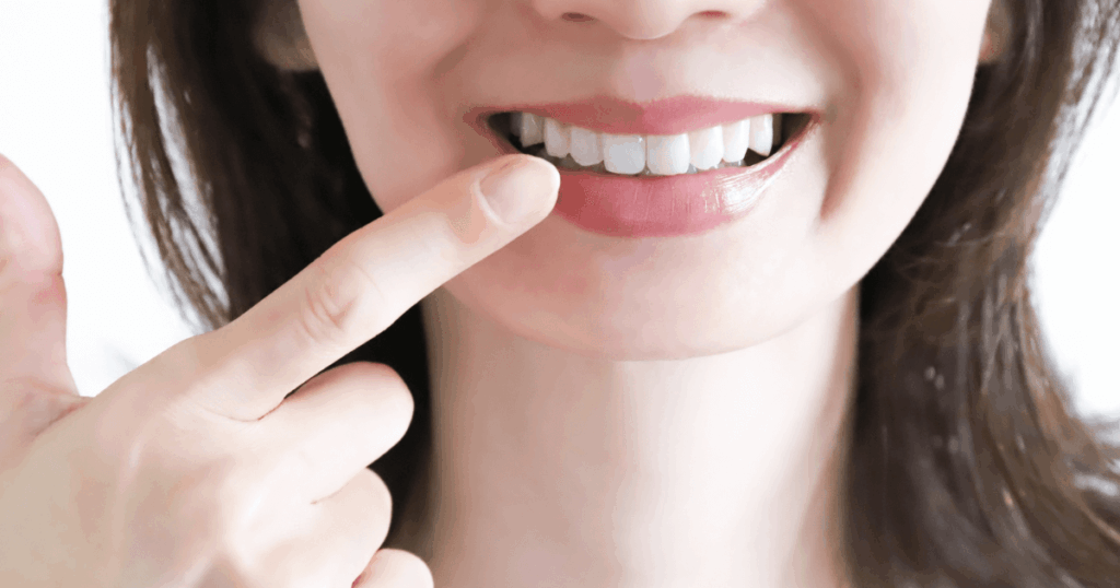 歯の被せ物の種類ごとの特徴を比較するイメージ画像