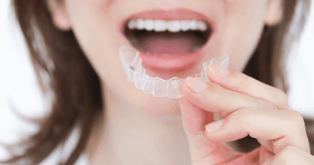 審美歯科で行うマウスピース矯正のイメージ
