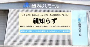 【保存版】親知らずが埋まっているかどうかはレントゲンでわかるのか？