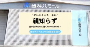 【医師監修】歯が欠けたのに痛くないのはなぜ？歯が欠けたときの対処法も紹介