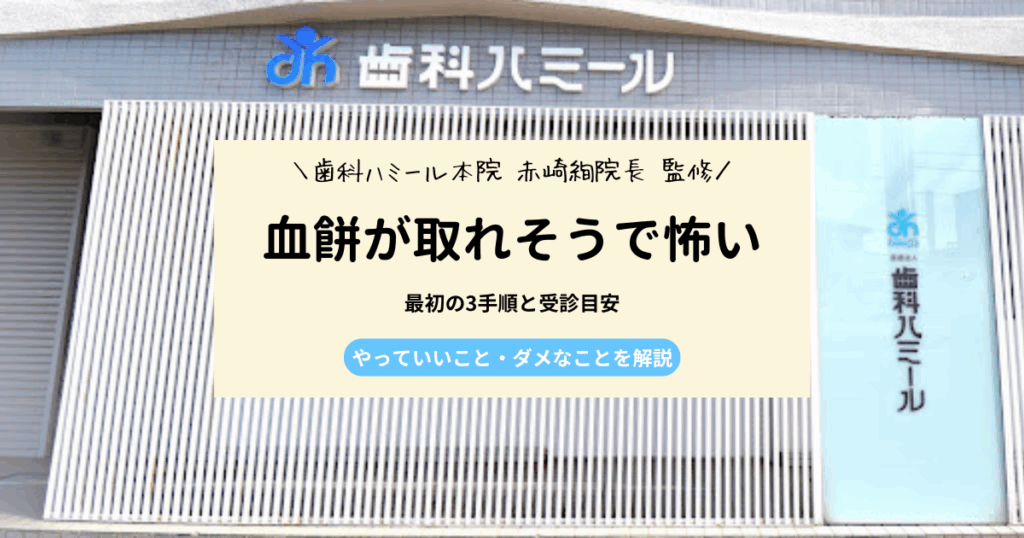 血餅が取れそうで怖いときの最初の3手順と受診目安｜やっていいこと・ダメなこと