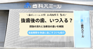 抜歯後の歯が入るまでの期間や治療の流れを説明するアイキャッチ画像