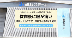抜歯後の喉の痛みに関する記事のアイキャッチ画像