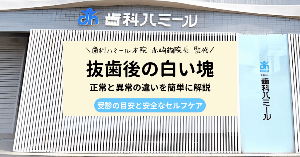 親知らずの抜歯後の白い塊とにおいが正常か分かる5つのチェック