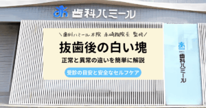 抜歯後の白い塊の正常と異常の違いを解説する記事のアイキャッチ画像