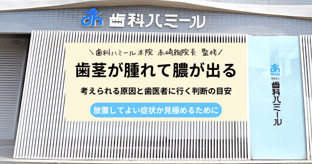 歯茎が腫れて膿が出る原因3つと歯医者に行く判断の目安