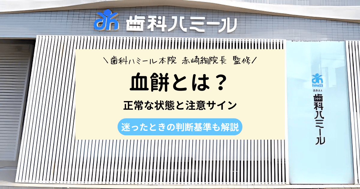 血餅とは？抜歯後に取れたかどうか判断する6つのポイント｜半田市の歯医者なら 歯科ハミール