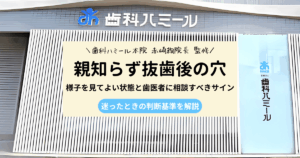 親知らず抜歯後に穴が空いて見える状態と様子見・受診判断を解説する歯科記事のアイキャッチ画像