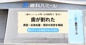 歯が割れたときの応急処置や受診の目安を解説する記事のアイキャッチ画像