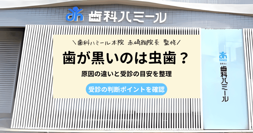 歯が黒いのは虫歯じゃない？見分け方と受診の考え方を解説