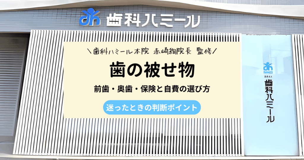 歯の被せ物はどれがいい？前歯と奥歯の選び方を徹底比較