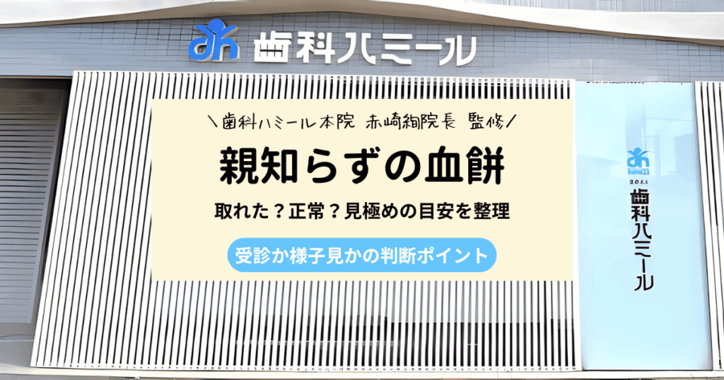 親知らずの血餅が取れたかもと不安なときに知りたい3つの判断ポイント