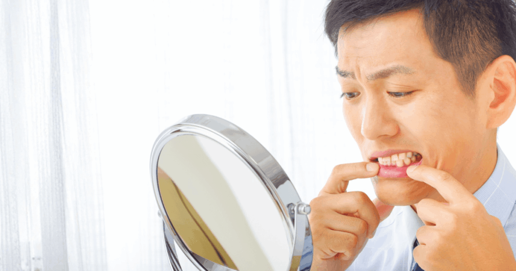 歯ぐきの腫れや出血に気づき歯医者受診を検討する人