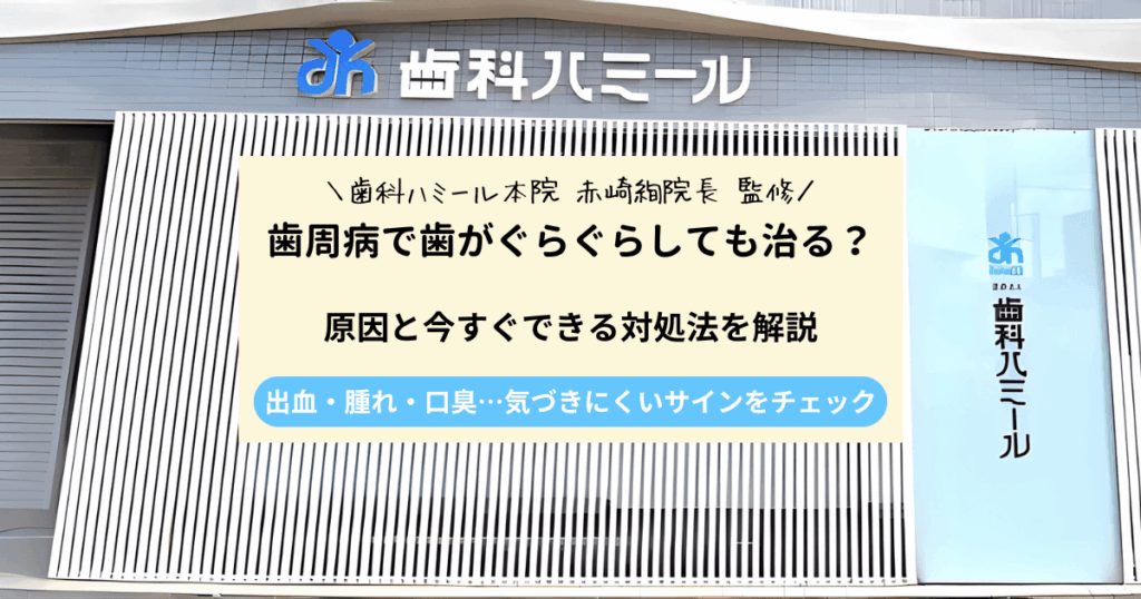 歯周病で歯がぐらぐらしても治る？原因と今すぐできる対処法を解説